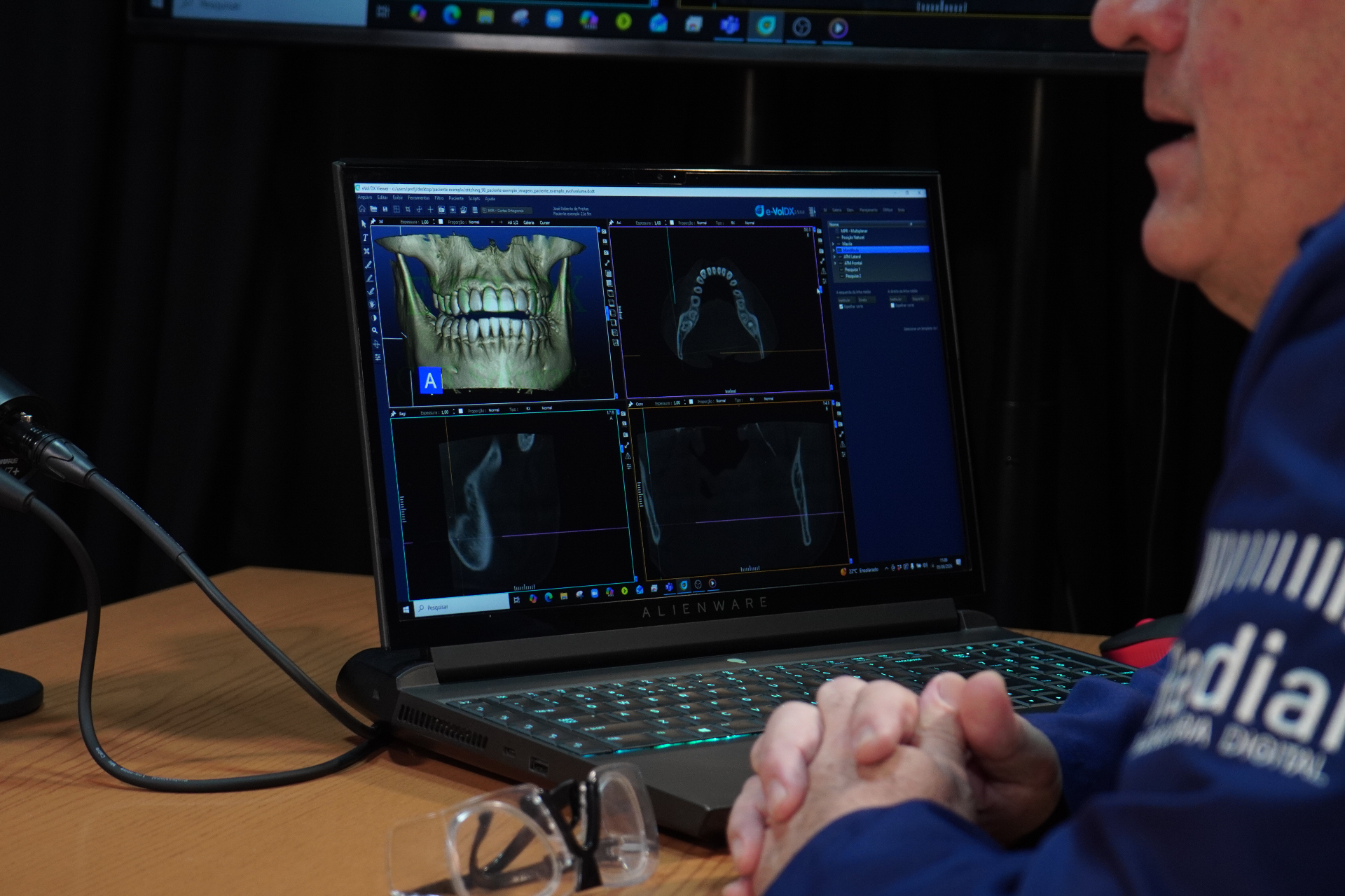 Análise de tomografia odontológica 3D